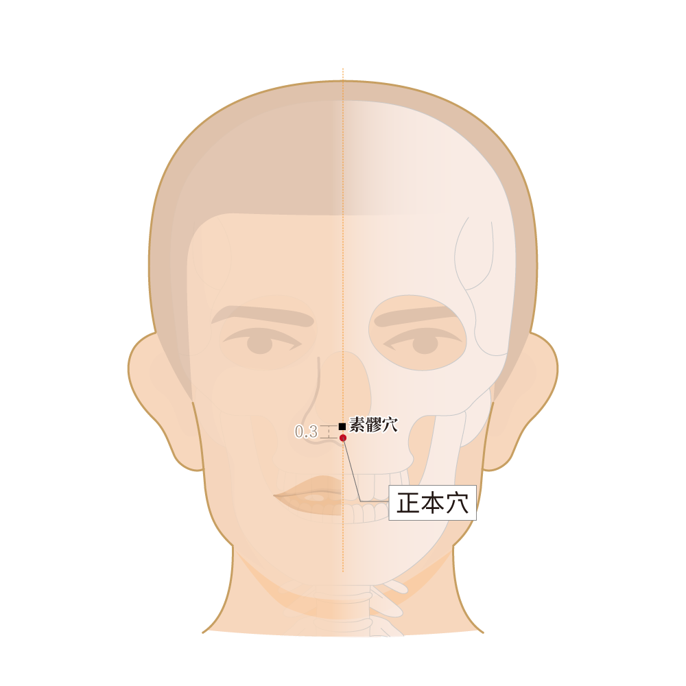 正本穴