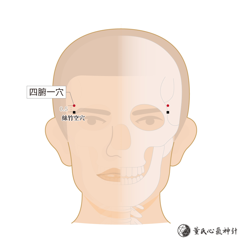 四腑一穴