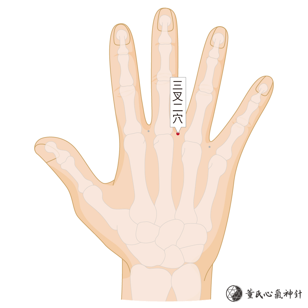 三叉二穴| 董氏心氣神針
