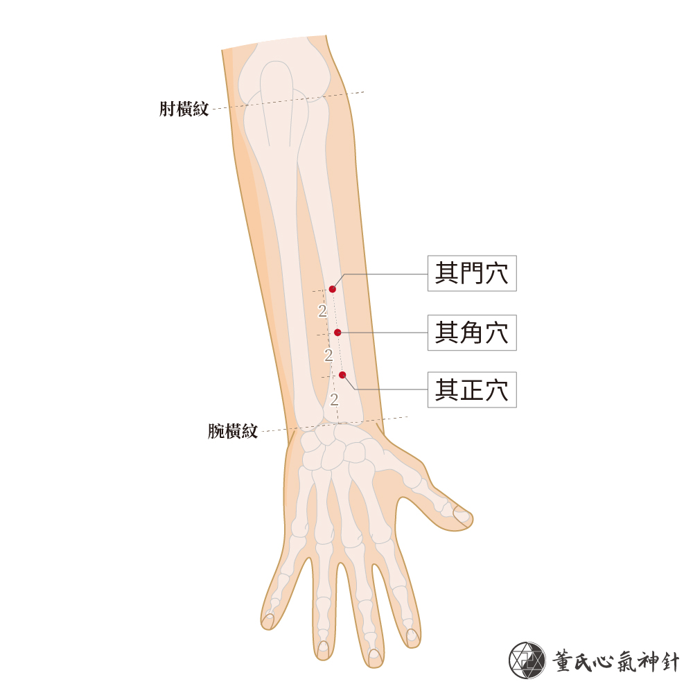 其門穴、其角穴、其正穴