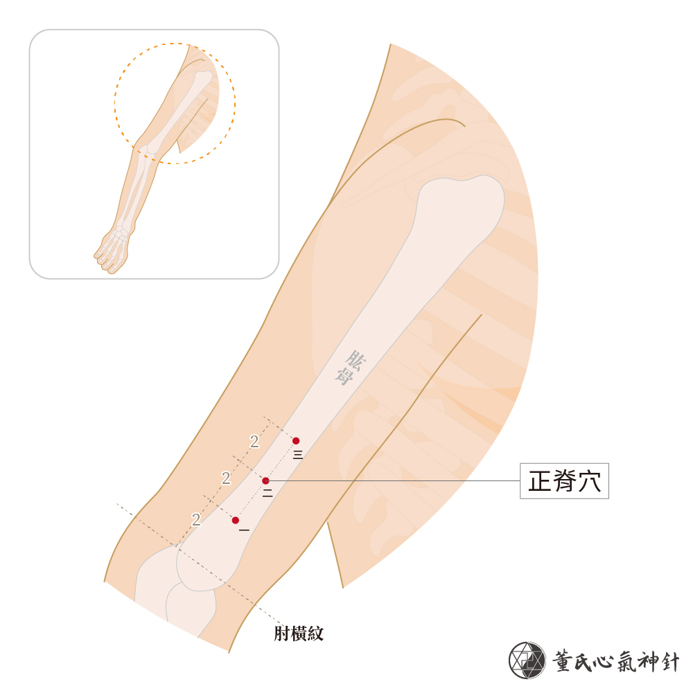 正脊一穴、正脊二穴、正脊三穴