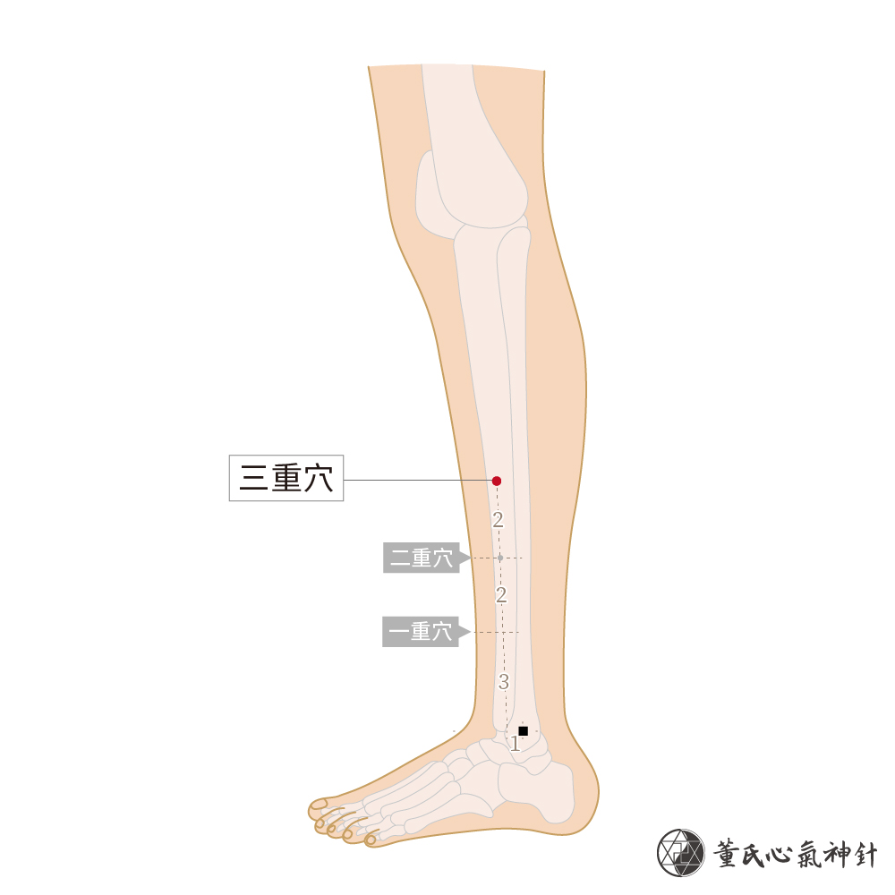 三重穴 董氏心氣神針 三重穴 董氏心氣神針