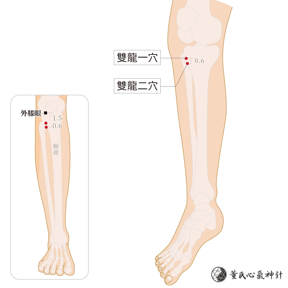 雙龍一穴、雙龍二穴