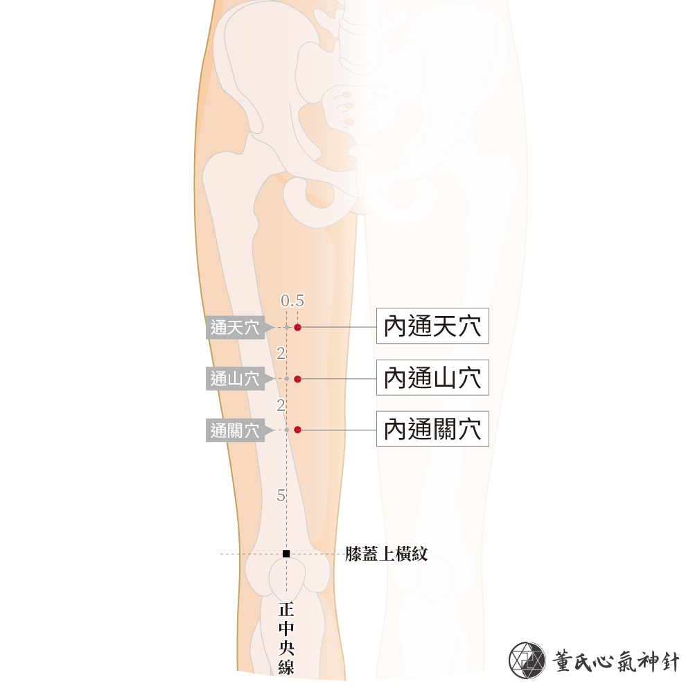 內通關穴、內通山穴、內通天穴