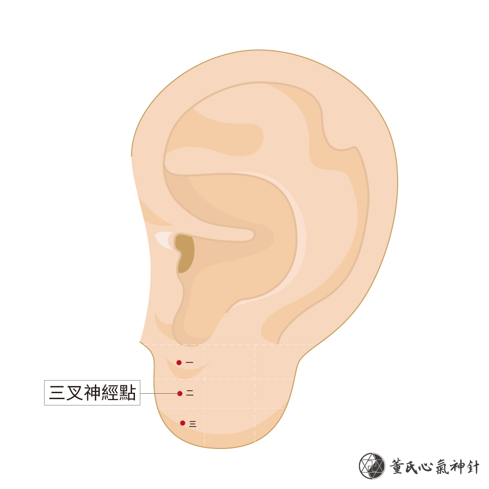 三叉神經點