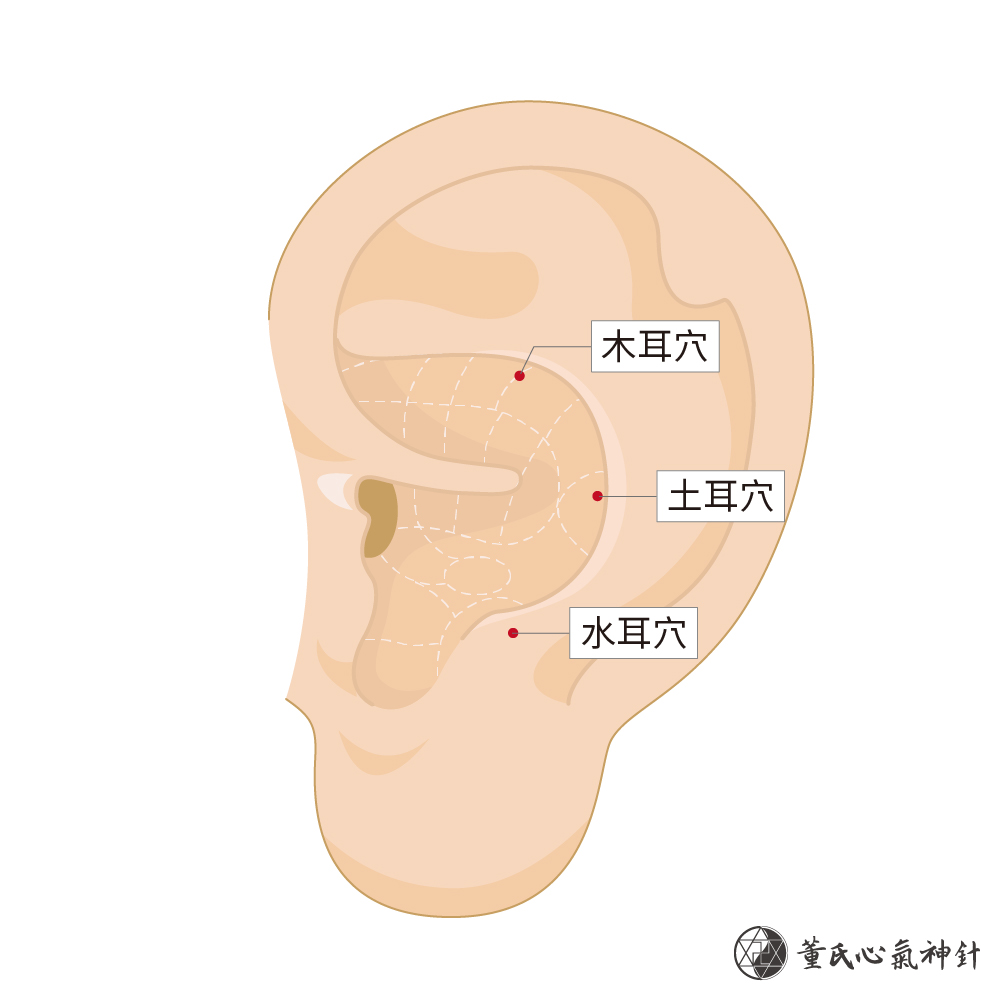 火耳穴、土耳穴、水耳穴