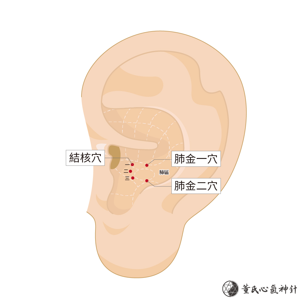 結核穴、肺金穴