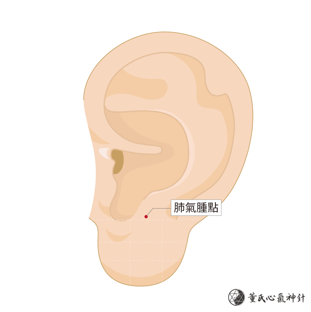 肺氣腫點