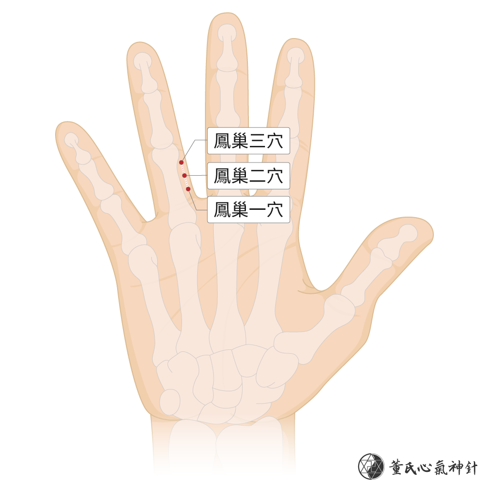 鳳巢穴位於無名指掌面巢區右手示意圖